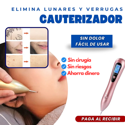 🔥Elimina imperfecciones al instante con el cauterizador - EBOOK GRATIS😍