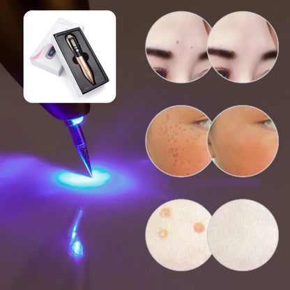 🔥Cauterizador SkinPro™ Elimina lunares y verrugas de tu piel al instante😍