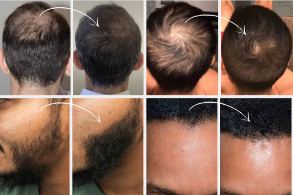 ✨ Eleva tu confianza en segundos con BUNEE™ - Relleno con acabado natural 😍 💎